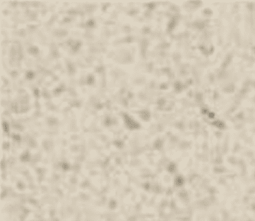 1 64 (3)